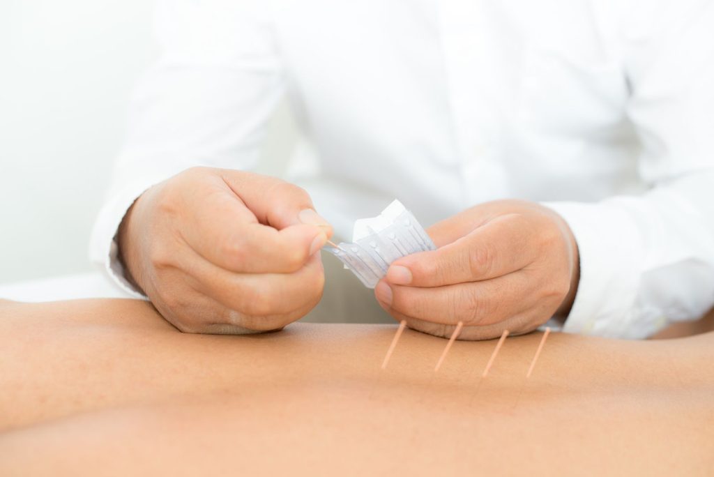Interviu cu dr. Ștefan Costescu, medic specialist în acupunctură